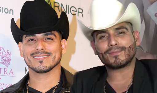 Espinoza Paz recurre a un implante de barba  