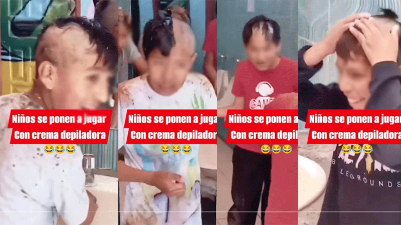 Niños juegan con crema para depilar y se quedan pelones 