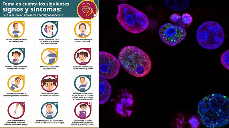 Realiza Querétaro acciones para la detección temprana y tratamiento oportuno del cáncer infantil 